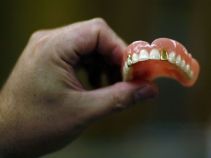 Lawsuit: Deadly Dentures Killed Miami Man