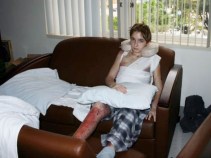 Badly Burned Teen Taken Back to Hospital