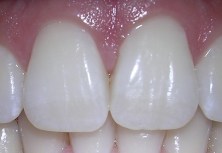 Funding Gets Drilled for Low Cost Dental Services