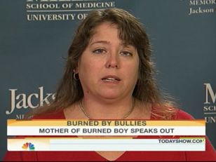 "This Violence Has Got to Stop": Burned Boy's Mom