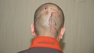 George Zimmerman Case Evidence