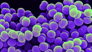 8 Dead in Fungal Meningitis Outbreak: CDC