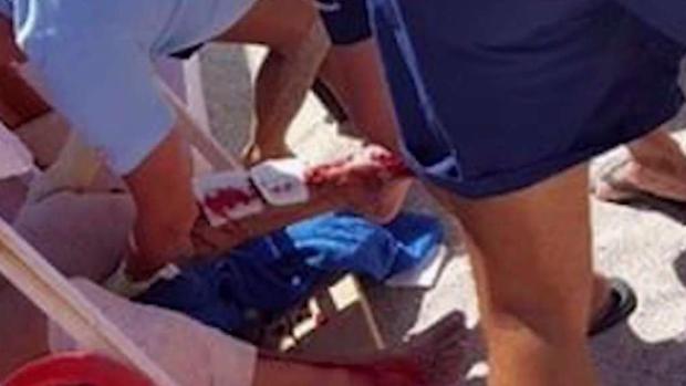Shark attack sends swimmer to the hospital Shark attack sends swimmer to the hospital