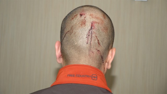 George Zimmerman Case Evidence