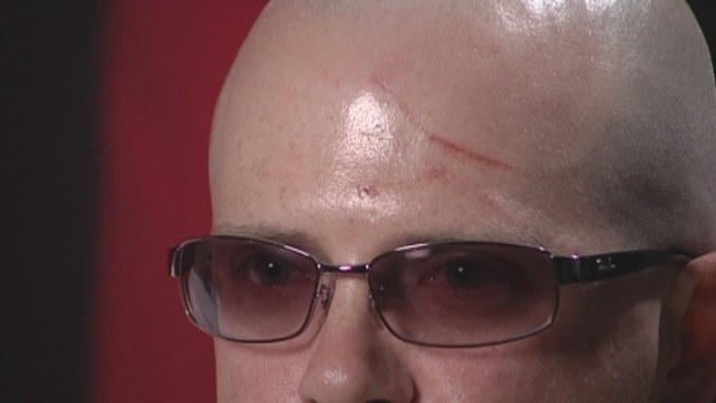 A Miami man who traveled to Tennessee for his 20-year high school reunion said he was attacked by a former classmate because he is gay, WSMV reported. Shawn Farris said he plans to file charges.