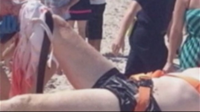 The man was swimming in waist-deep water when he suddenly felt pain below his knee. One caller reported that he was bleeding a lot, and another said there was 