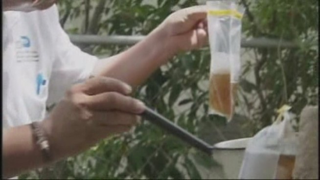 A 70-year-old woman is the first case of locally contracted Dengue Fever in Miami-Dade County in 2012, health officials said Thursday. Dr. Alvaro Mejia-Echeverry discussed the case and the disease.