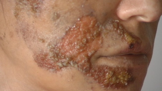 A woman was dragged by a getaway car in a Costco parking lot after she chased down a suspect who snatched her purse, police said. The 49-year-old woman, identified as Maria Beatriz Misk, suffered severe abrasions to her face, shoulder, hands and knees, a report said. Thomas Carney of the NMB Police Department told shoppers it's important not to resist a thieve.