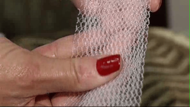 Surgical mesh used in pelvic repair surgeries is causing problems, reports say.