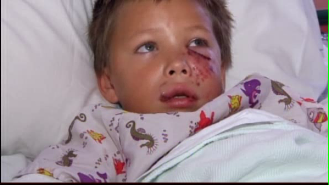 The 911 call of the pit bull attack on Nicholas Garvey was released Friday.