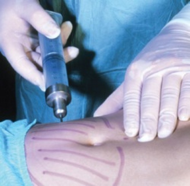 How Your Potbelly Could Save Lives