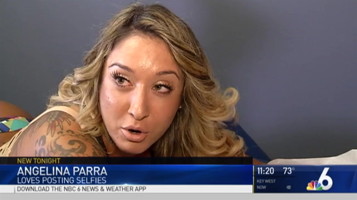 Increase in Surgery for Selfies