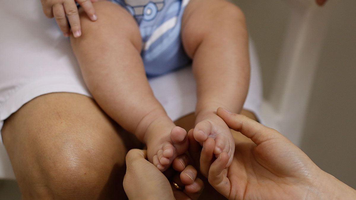 Second Baby Born with Zika in Miami-Dade County