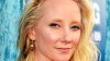 Anne Heche Dead at 53, Days After Fiery Car Crash
