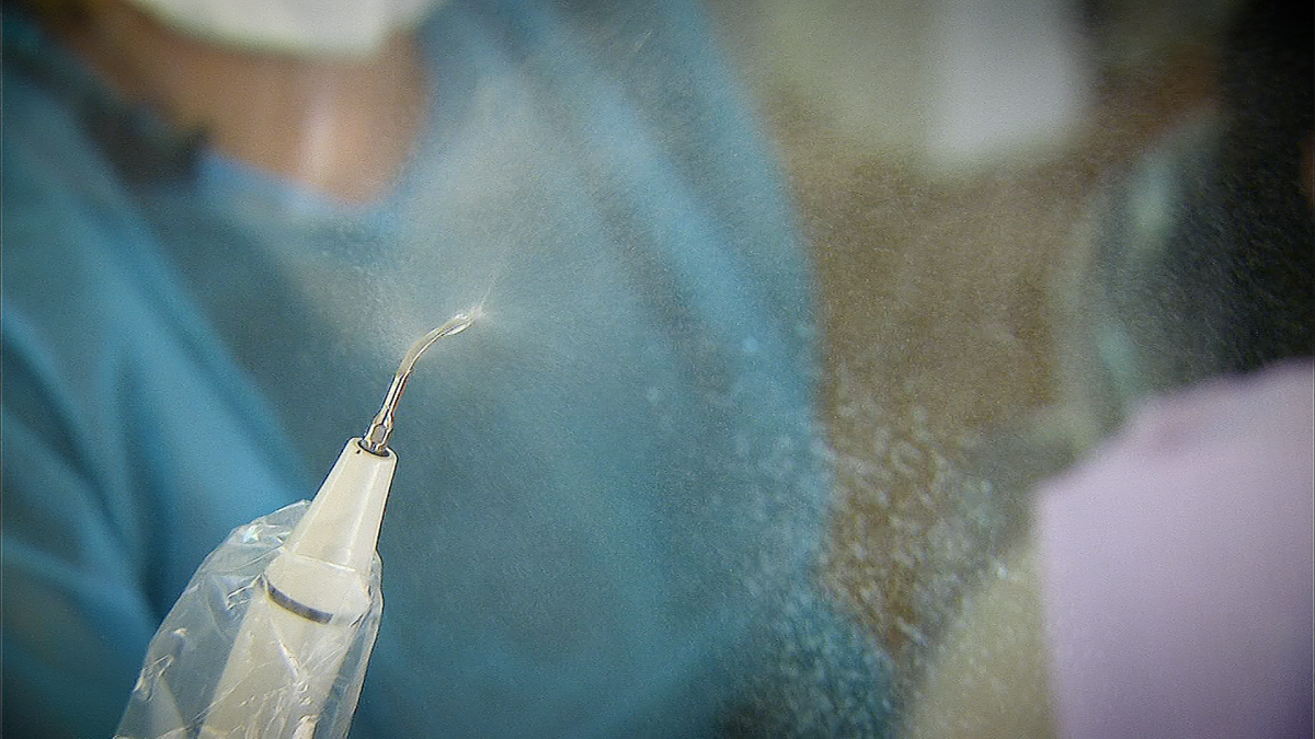 Potential COVID Aerosol Hazards in the Dentist Chair NBC 6 South Florida