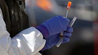 A hospital staff member holds a coronavirus testing swab during the COVID-19 pandemic on May 4, 2020.