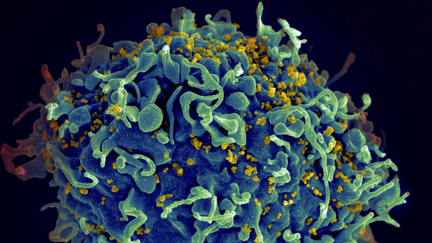 HIV-T-Cell