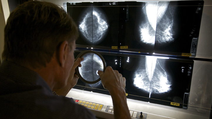 Mammograms Cuts