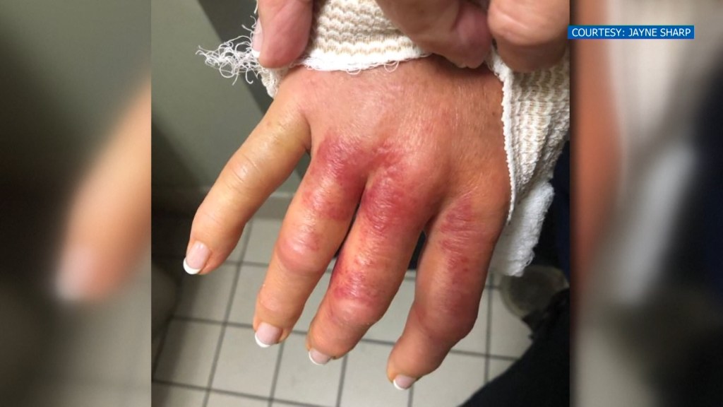 Https Www Nbcmiami Com News Local Mi Raw Video Yacht Washes Ashore On Palm Beach 64423 Https Media Nbcmiami Com 2019 09 Nbc 3x 7 1 Png Fit 1024 2c576 Raw Video Yacht Washes Ashore On Palm Beach Raw Video Yacht Washes