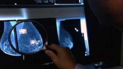 Breast Cancer Awareness Month: How to lower your risk of developing this disease