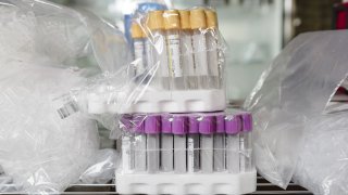 Test tubes sit on a shelf at The Odin biohacking supply company in Oakland, California, U.S., on Wednesday, June 24, 2020. As Covid-19 continues its march around the globe, scientists have embarked on an unprecedented campaign to develop a vaccine against the disease.