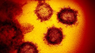 This transmission electron microscope image shows SARS-CoV-2—also known as 2019-nCoV, the virus that causes COVID-19. isolated from a patient in the U.S., emerging from the surface of cells cultured in the lab.