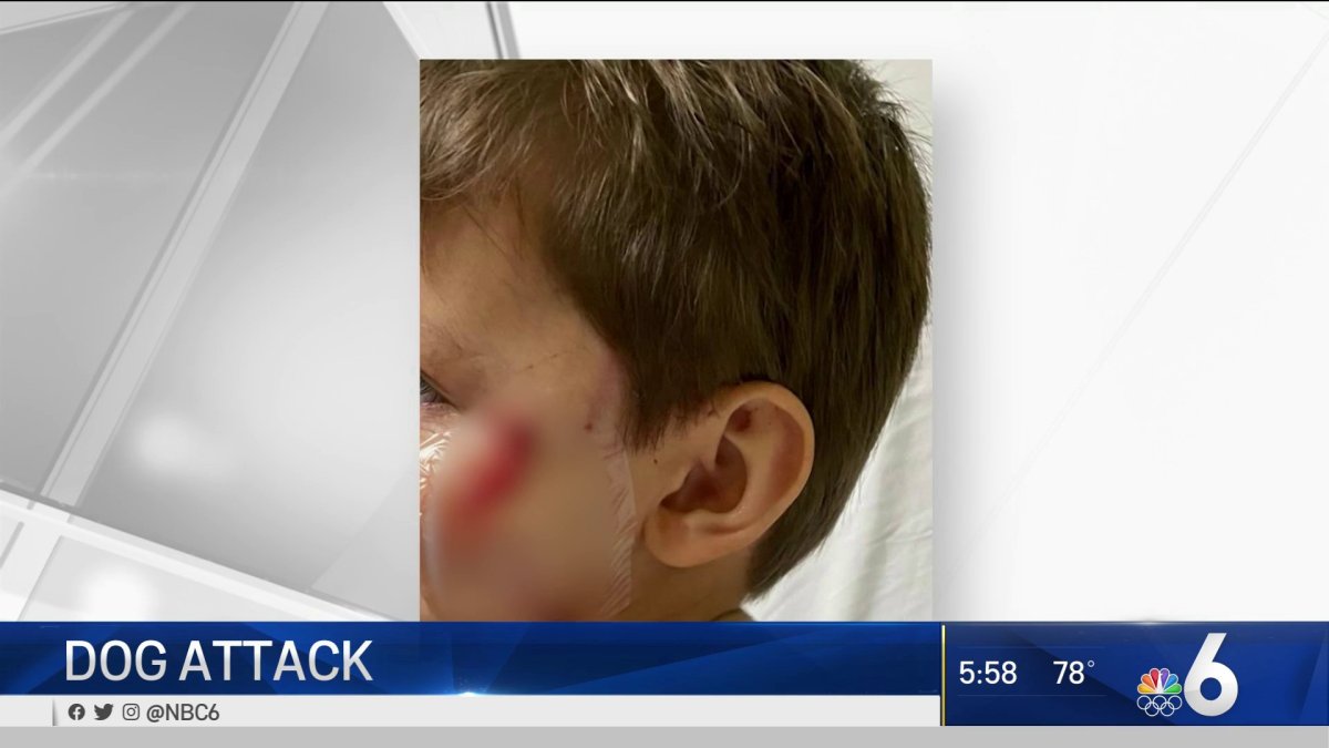 Unleashed Dog Attacks Child, Dad at Miami Park – NBC 6 South Florida