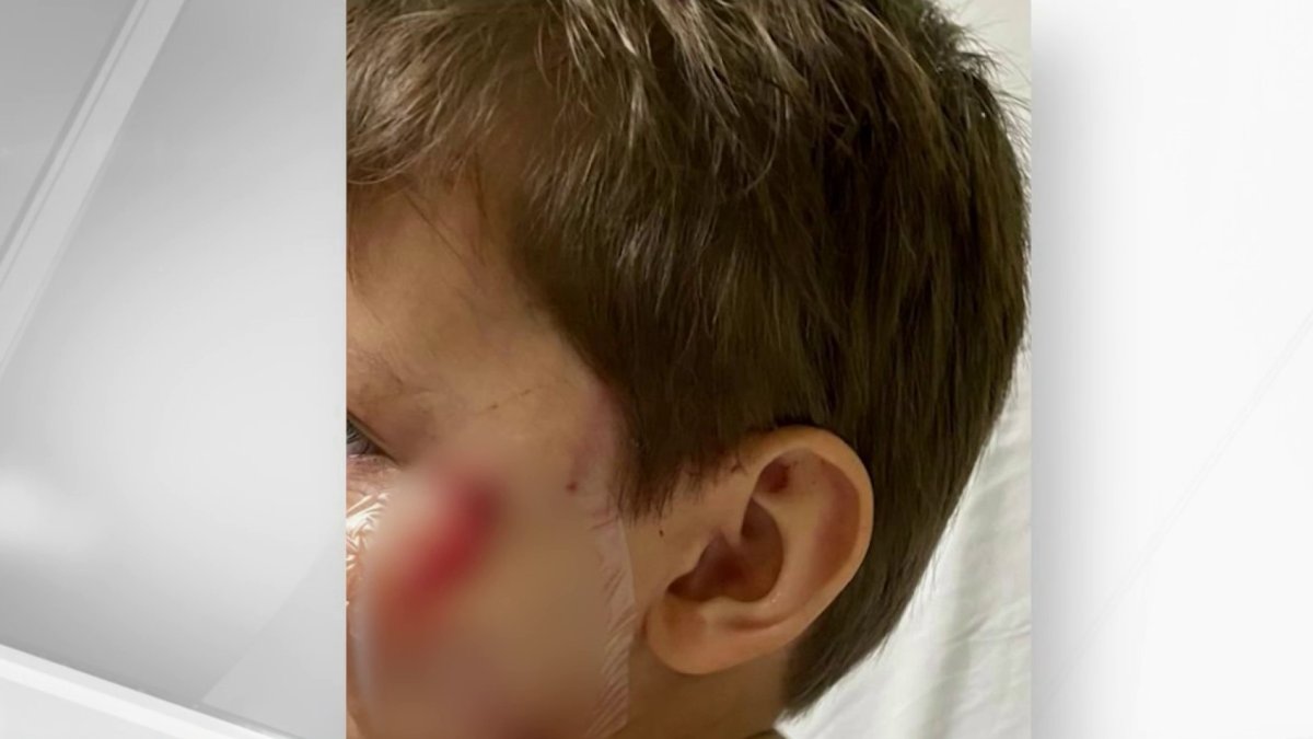 Miami Police Cracks Down on Leash Laws After Dog Attack NBC 6 South