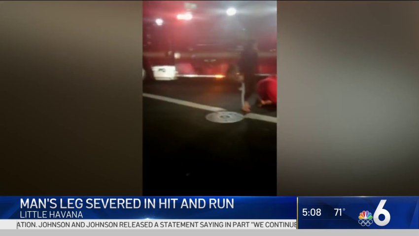 Man's Leg Severed in Hit and Run Crash in Little Havana