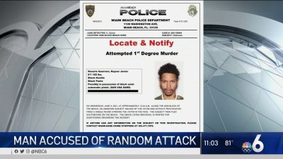 Man Accused of Randomly Shooting Tourist in the Face