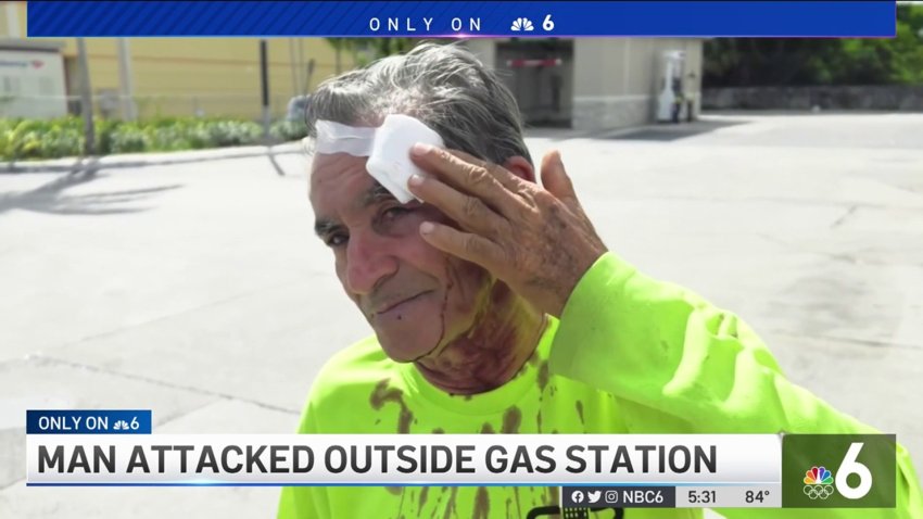 Man Attacked Outside Opa-Locka Gas Station
