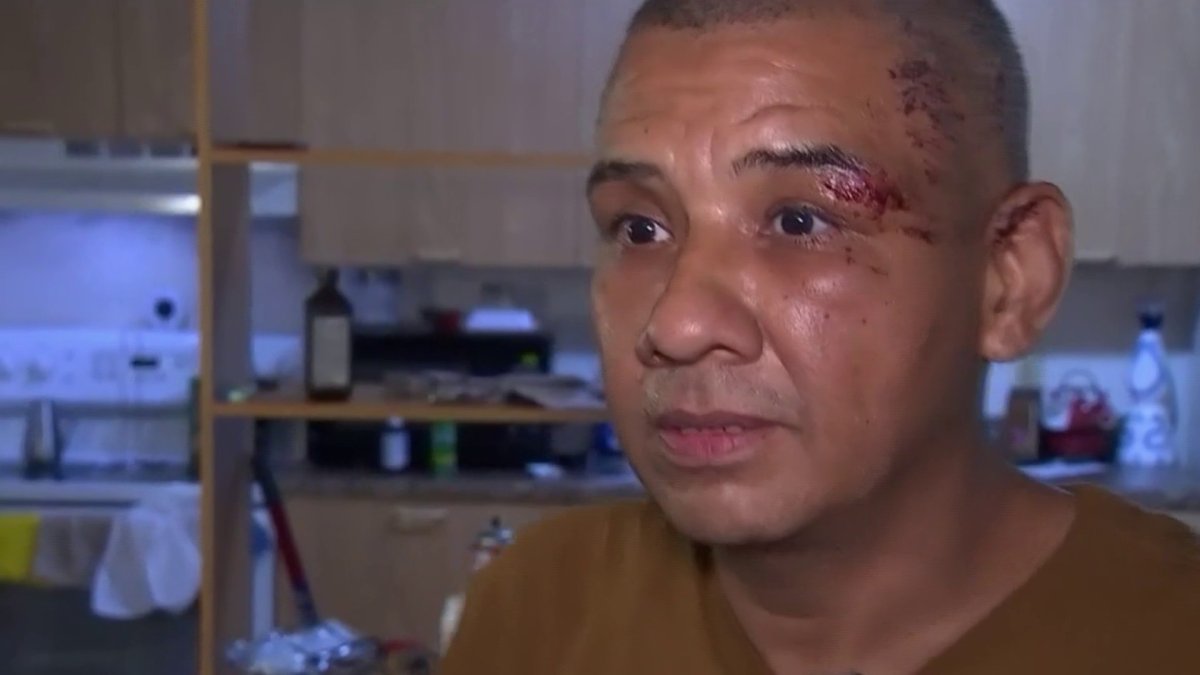 Miami-Dade Home Invasion Victim Speaks Out About Brutal Attack – NBC 6 ...