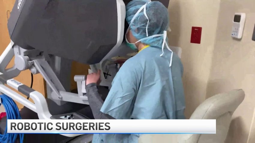 The Advancements in Robotic Surgeries