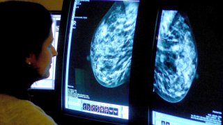 A consultant analyzing a mammogram.