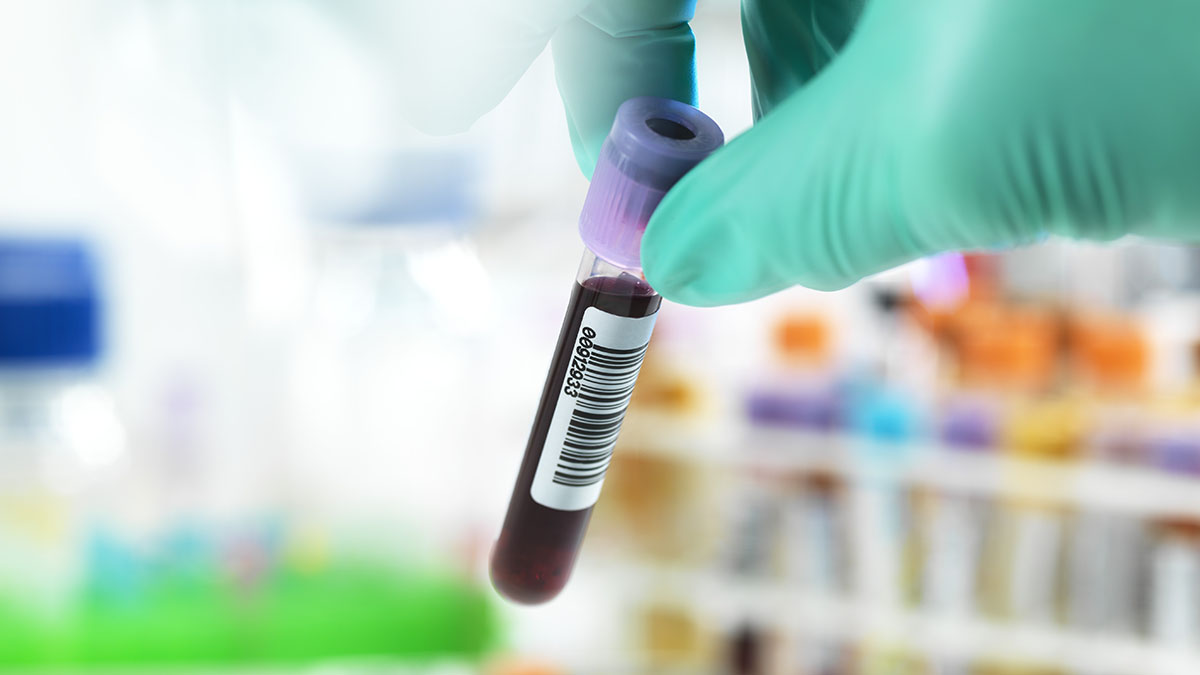 Florida bill could make biomarker testing more accessible for cancer