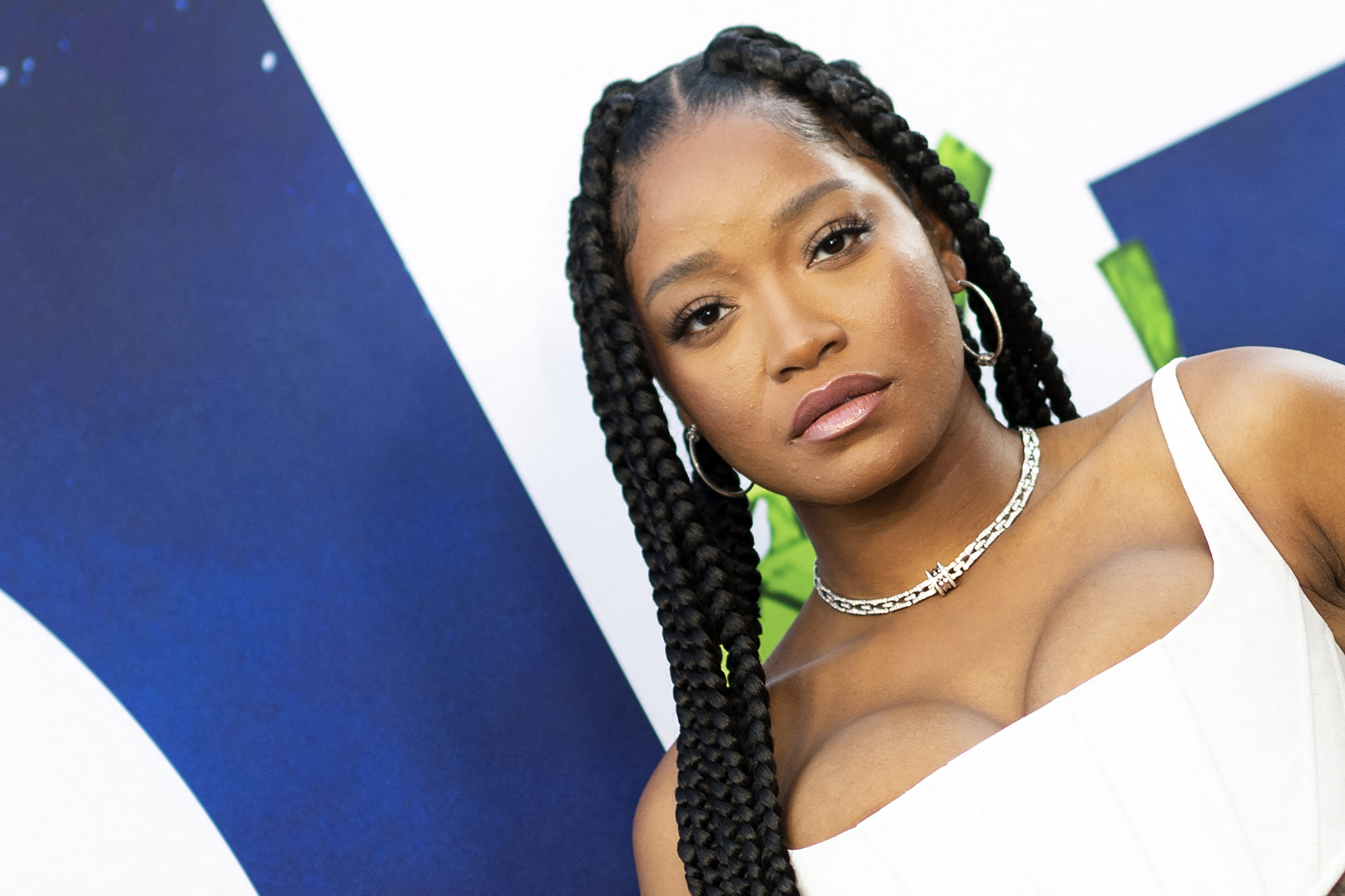 Keke Palmer Says ‘Protect Those Eyes’ After Sunburning Retina