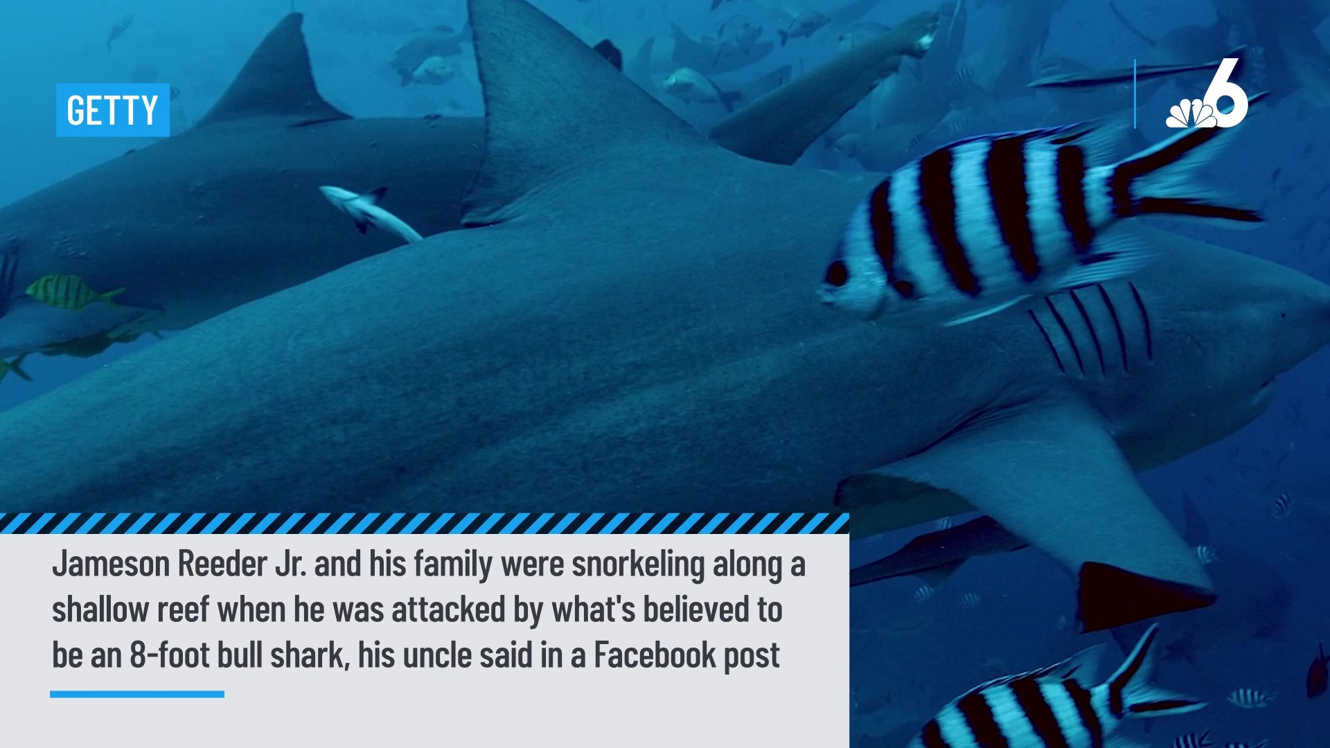 Boy, 10, Loses Part of Leg in Florida Keys Shark Attack: Family – NBC 6  South Florida