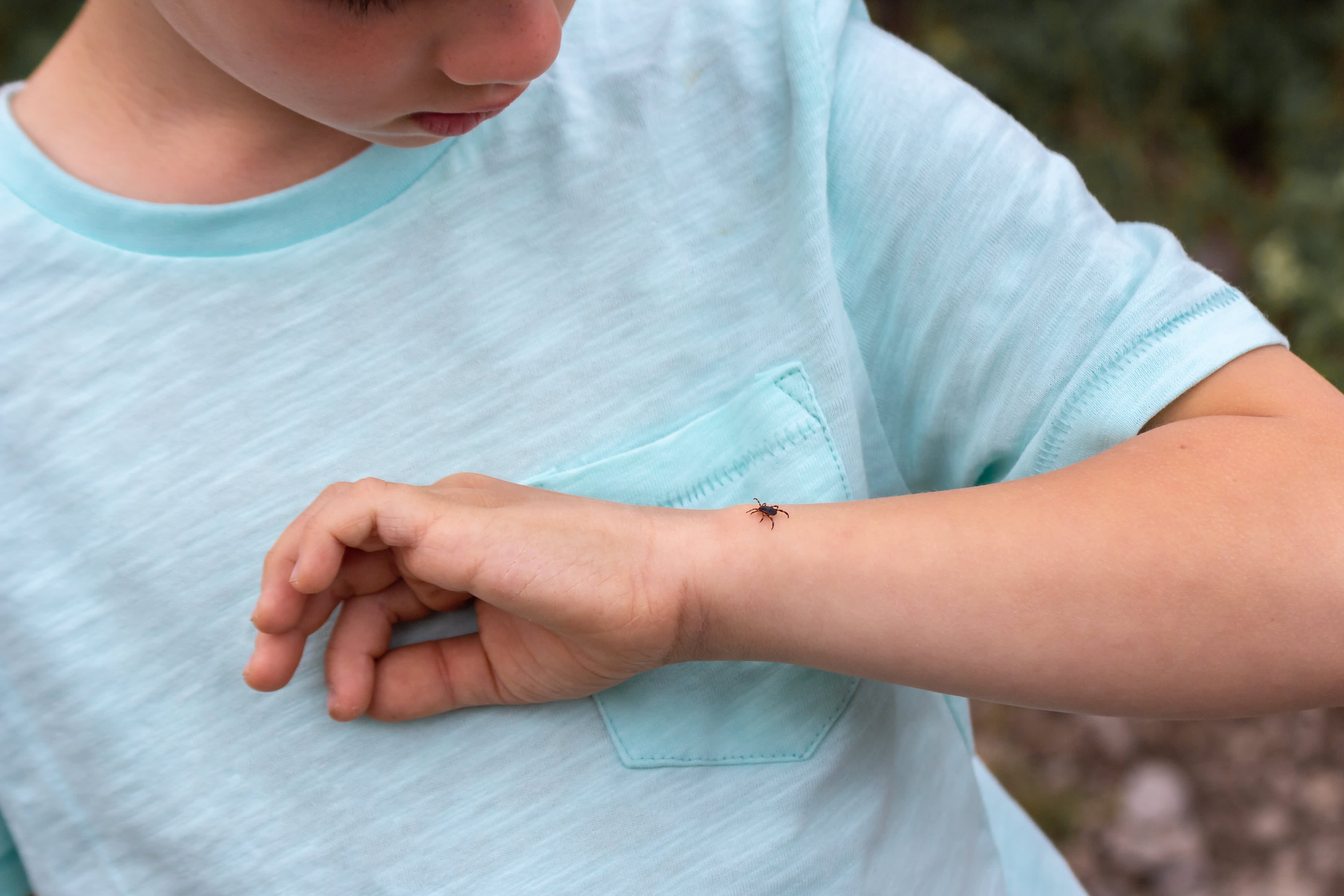 Powassan Virus Is in the News: Here Are 6 Facts About the Tick-Borne Illness - Vimarsana News
