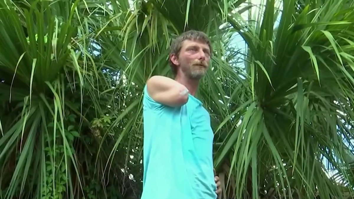 Man Shares Survival Story After Losing Arm in Alligator Attack Near(00)