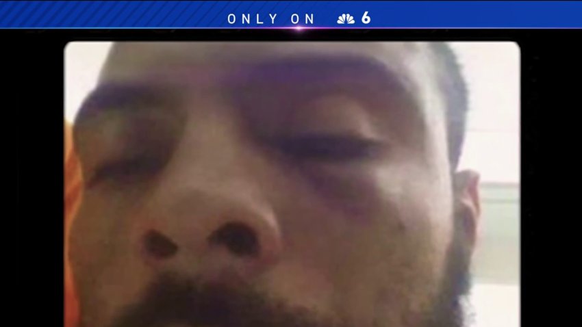 Former Inmate Says Miami-Dade Corrections Officers Beat Him Up