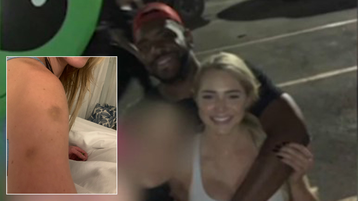 Miami OnlyFans Model’s Bruised System Found in Photos Following Boyfriend’s Killing Miami OnlyFans Model’s Bruised System Found in Photos Following Boyfriend’s Killing