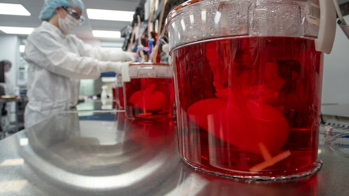Scientists Seek to Use Pig Livers to Ease Organ Shortage – NBC 6 South Florida - Vimarsana News