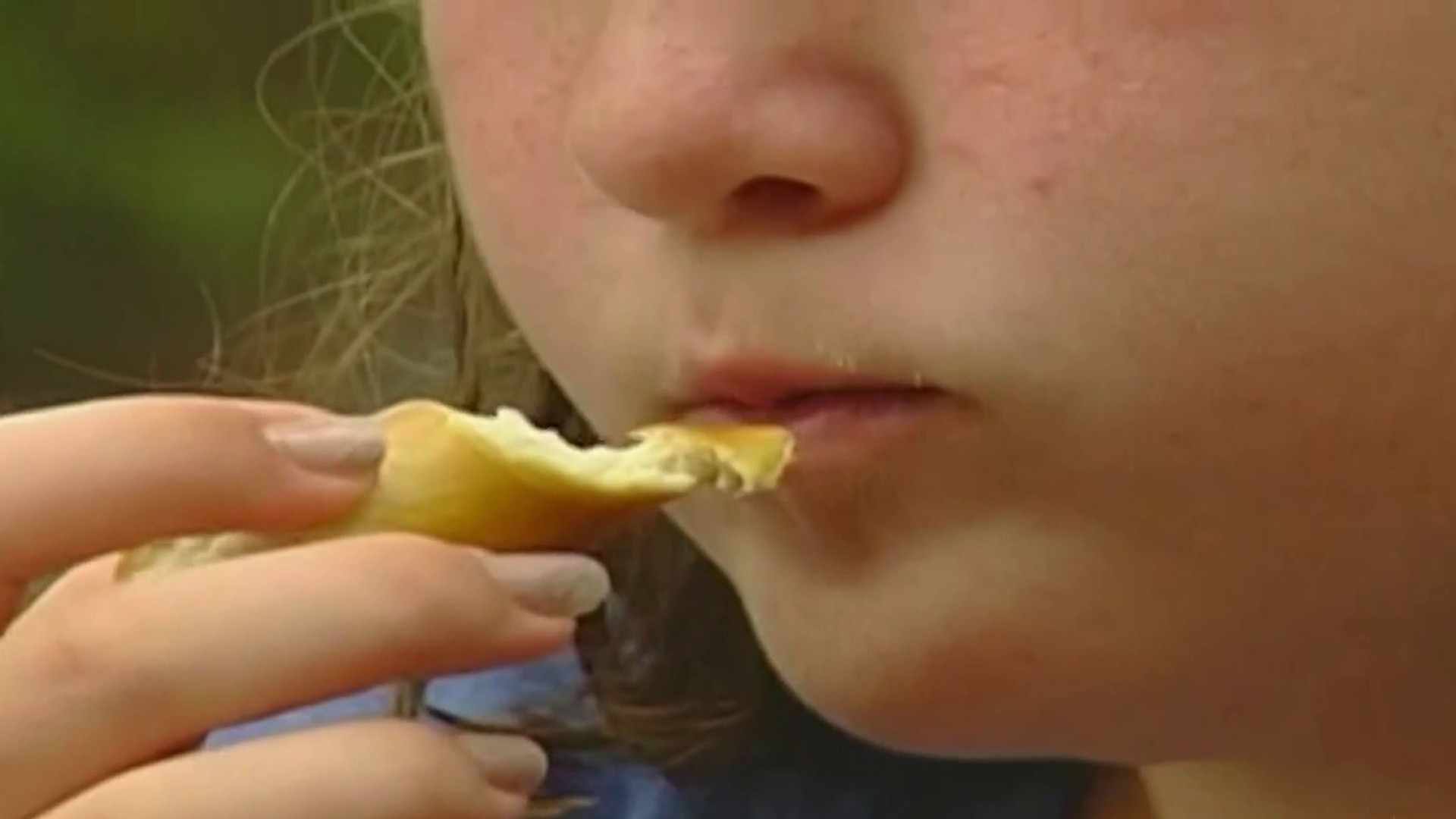 Medication, Surgery Among New Guidelines to Treat Childhood Obesity