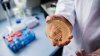 Florida Among Top 6 States With Alarming Spread of Deadly Fungal Infection. Here's What You Need to Know