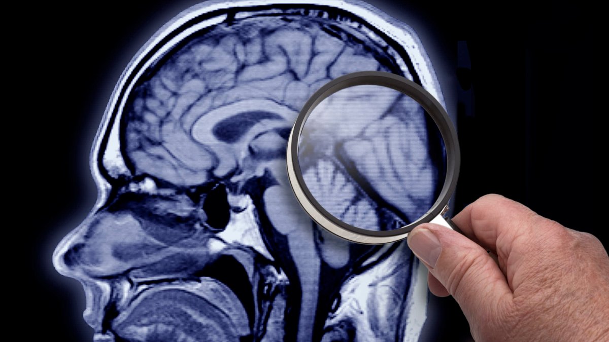 Campaign aims to raise Alzheimer's awareness in Hispanic communities - Vimarsana News