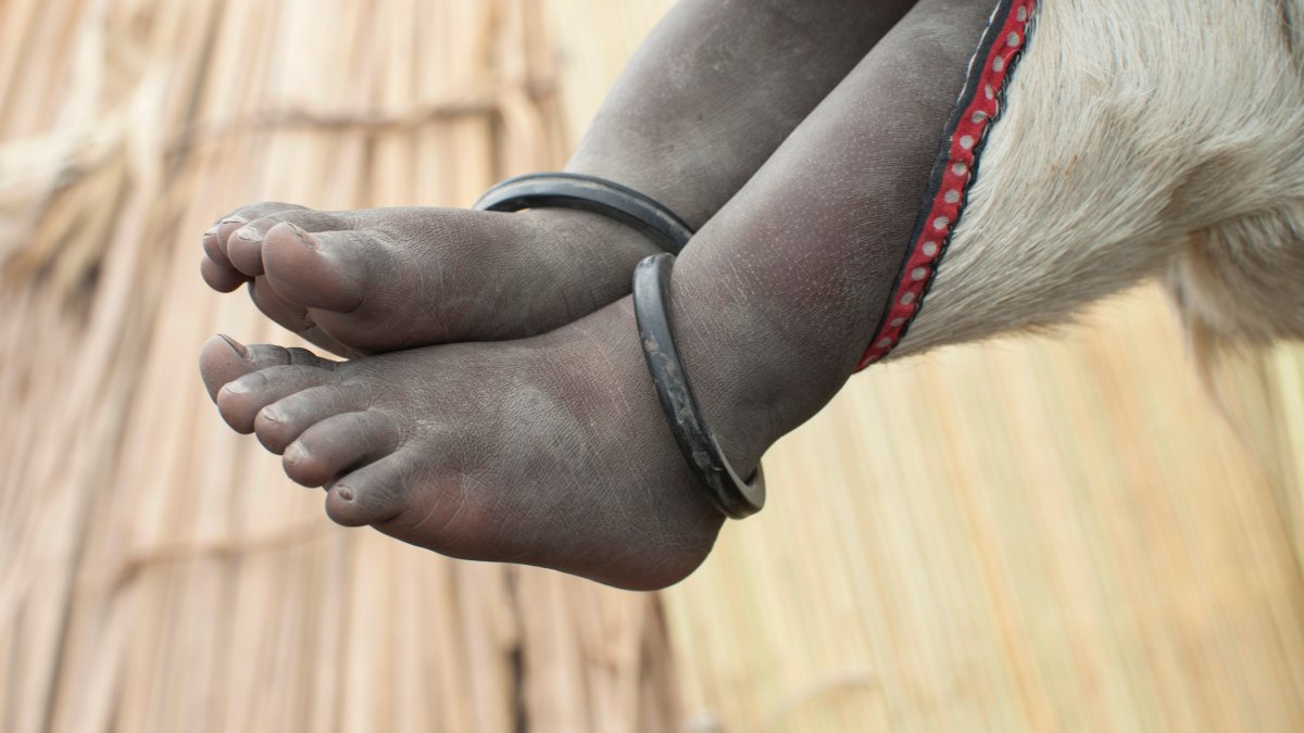 300 children rescued after 71 died in a Sudanese orphanage – NBC 6 South Florida - Vimarsana News