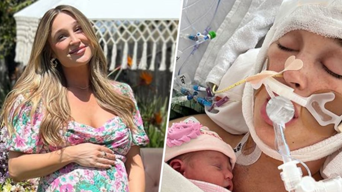 Influencer in Coma Immediately after Brain Aneurysm Ruptured at 9 Months Pregnant