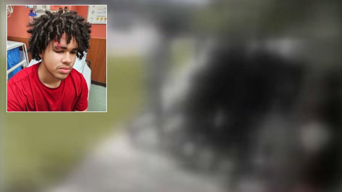 'They are savages': Father of Pembroke Pines student attacked at school demands answers – NBC 6 South Florida - Vimarsana News
