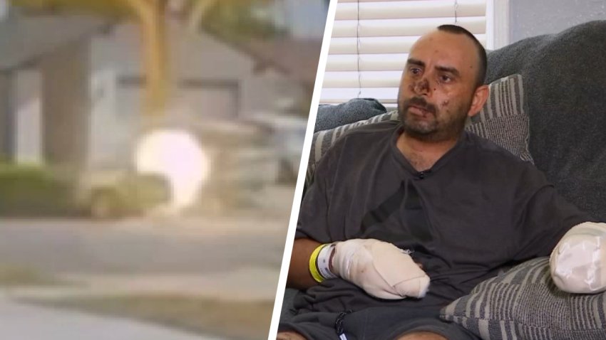 Left: A ball of fire forms in front of a house. Right: Hector Mayoral sits on a couch, with both hands bandaged.