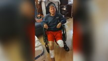 Man loses part of his leg after hit-and-run in Hollywood – NBC 6
